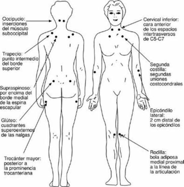 Dia per fer visible la fibromiàlgia, fatiga crònica i SQM