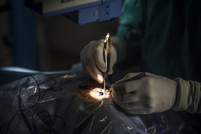 ASCAMM i Barcelona Macula Foundation uneixen coneixements per lluitar contra la ceguesa