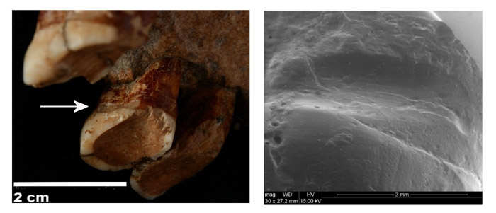 La UAB confirma que els neandertals usaven escuradents per calmar el dolor