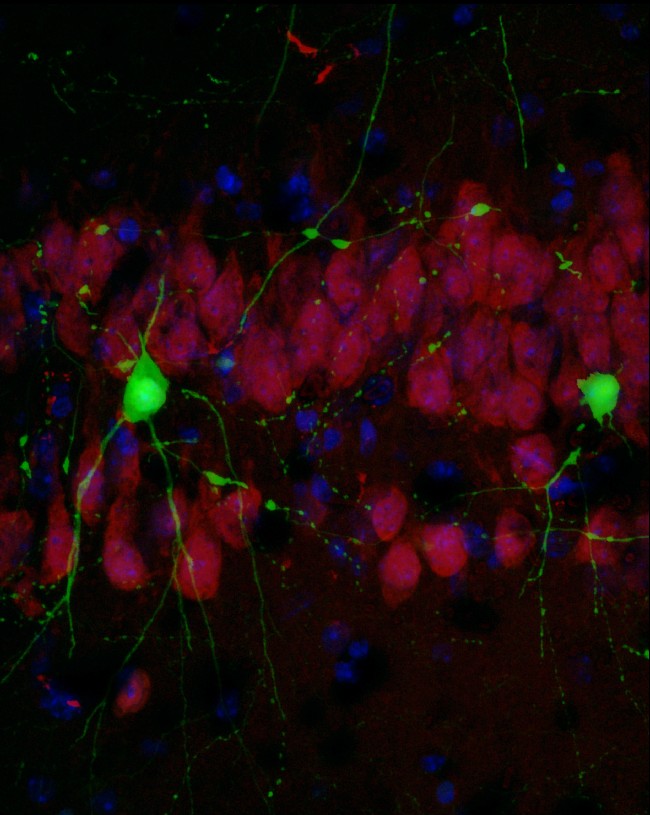 Investigadors de la UAB fan un pas important contra l'Alzheimer inicial