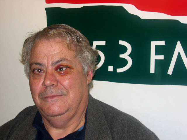 Un veí de Cerdanyola triga més d'un any en poder-se operar d'una intervenció sense ingrés hospitalari