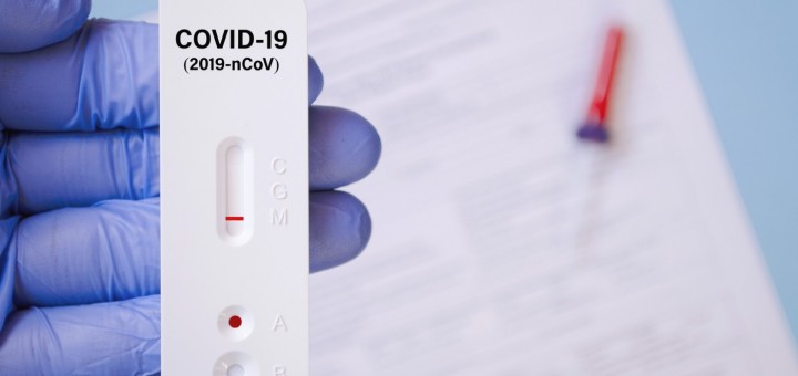 L'associació Cerdanyola Comerç i Serveis promou una campanya de test d’antígens